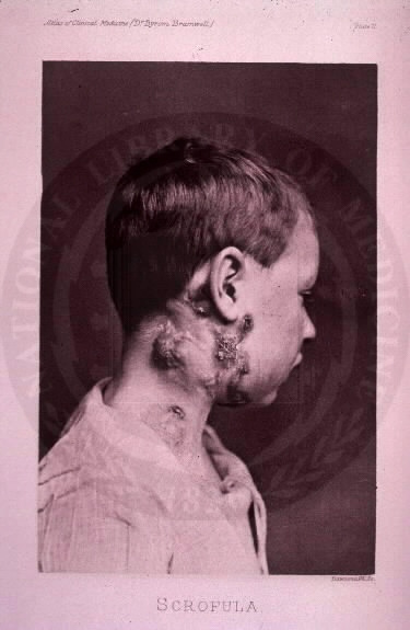 No larger image available